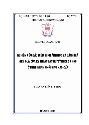 5 luận án tiến sĩ nqa