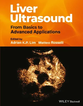 2024 liver ultrasound from basics to advanced applications wiley blackwell