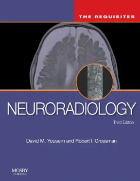 Neuroradiology hình ảnh học thần kinh