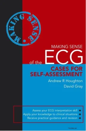 Case lâm sàng ecg