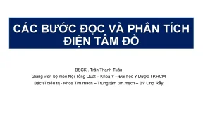 Các bước đọc điện tâm đồ cơ bản